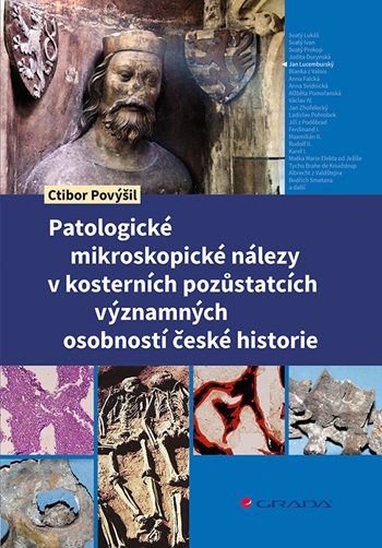 Patologické nálezy kosterních ostatků